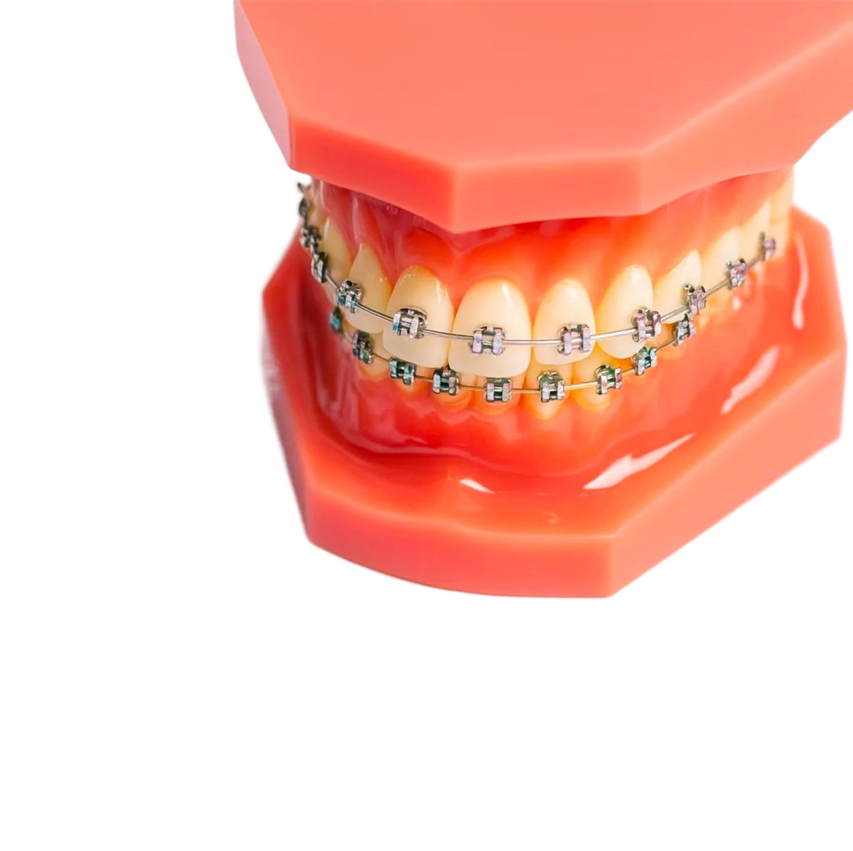 Ligas para Brackets | Ligaduras Elásticas de Ortodoncia | Pack 10 Bastones Multicolor